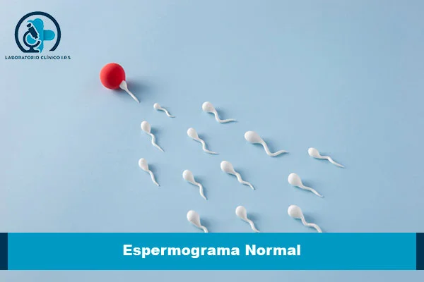 espermograma normal